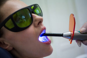 Laser dentaire Cachan