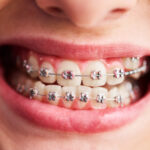 orthodontie cabinetdentairecachan
