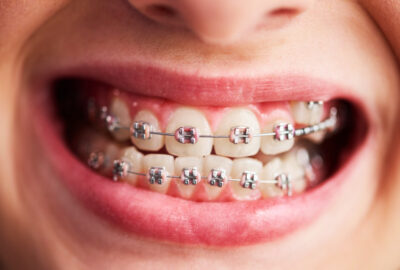 orthodontie cabinetdentairecachan