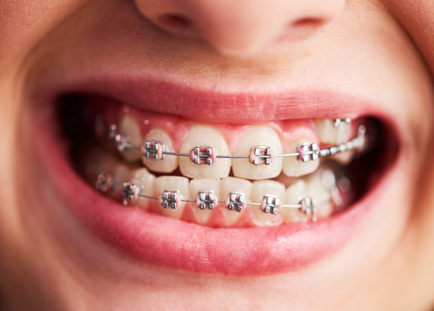 orthodontie cabinetdentairecachan