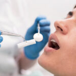 Microfissures de l’émail