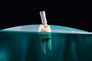 image article