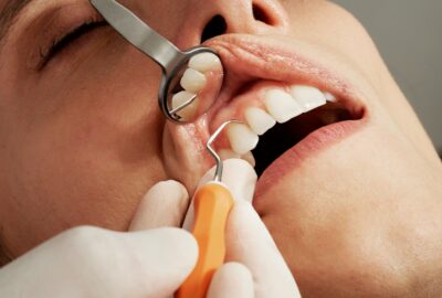 sourire, dents, hygiène dentaire