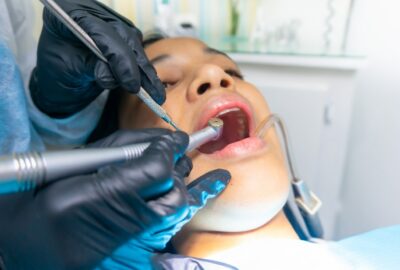 Chirurgie orale : interventions, préparation et suivi post-opératoire
